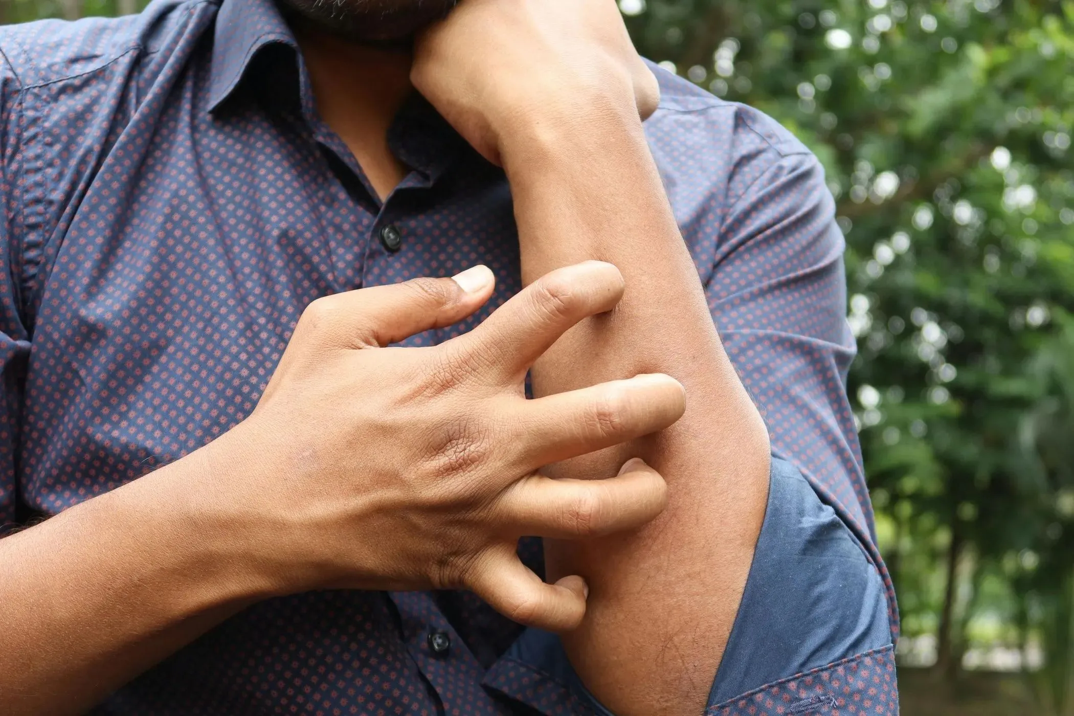 Fungal infections