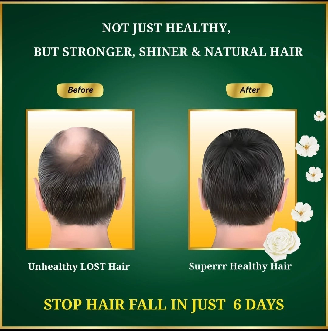 Ayurvedic Hair Fall Oil 6