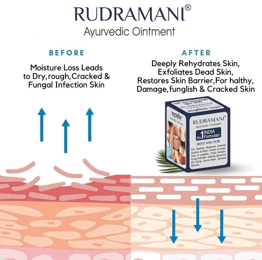 Rudramani Ayurvedic Malam
(Cream) For Anti-Fungal Infection,Itching & Skin Recovery For All Skin Types 25gm 6