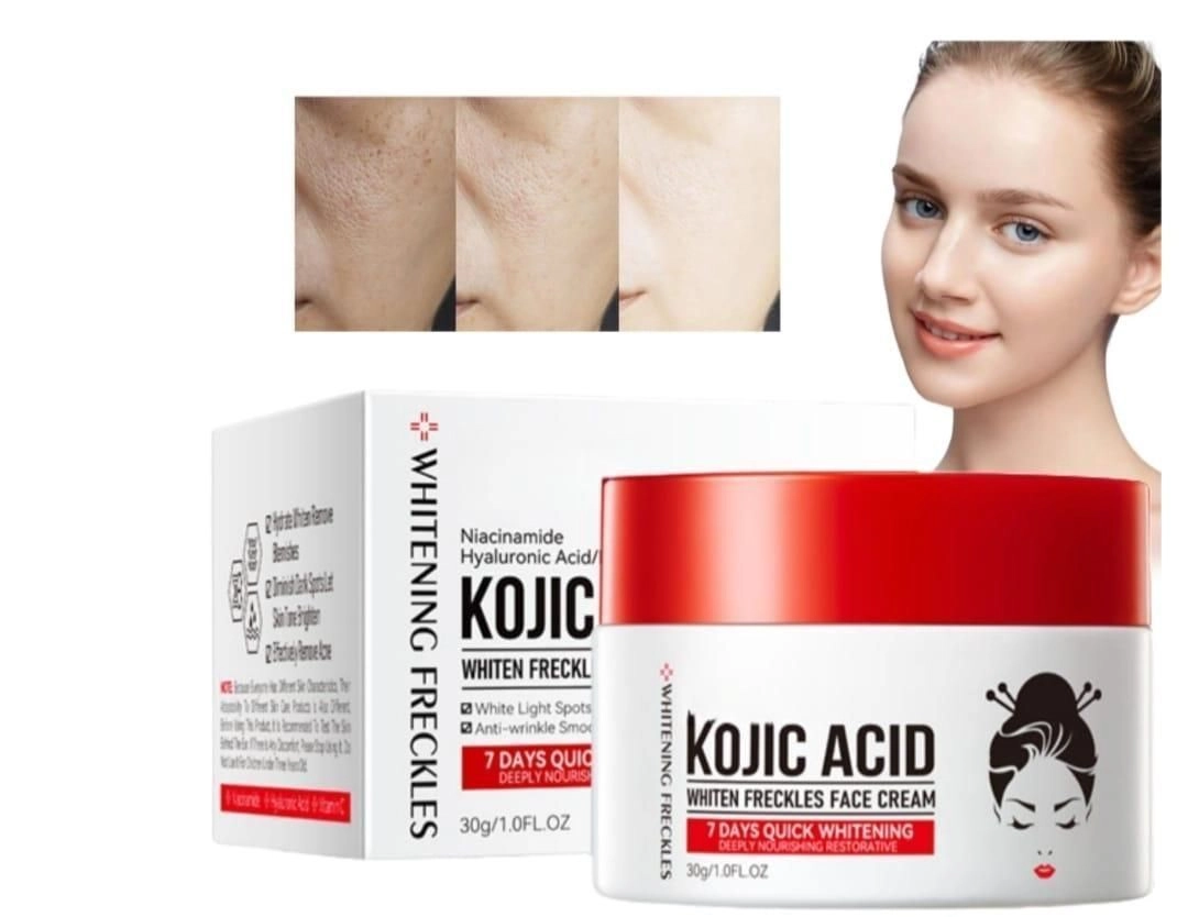 Kojic acid whitening cream- most famous international product