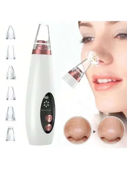 6-in-1 Electric Blackhead Remover – Facial Pore Vacuum 2
